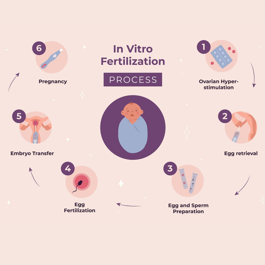 In Vitro Fertilization (IVF): A Comprehensive Overview