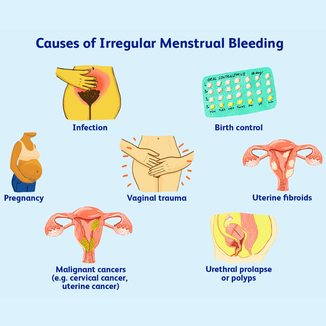 Understanding Irregular Periods: Causes, Disadvantages, and Remedies